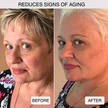 Load image into Gallery viewer, Vitamin C Serum | Get a FREE Vitamin C Cleansing Water